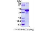 CLNS1A, 1-237aa, Human
