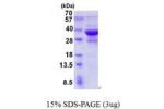 SH3GLB1, 1-365aa, Human