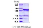 PSMD9, 1-223aa, Human