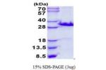 LGALS3, 1-264aa, Mouse