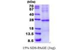 TNNI2, 1-182aa, Human