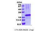 RCAN3, 56-241aa, Human
