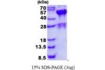 SH3GLB2, 1-395aa, Human