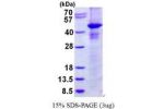 RASSF1A, 1-340aa, Human