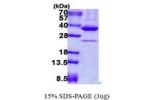 PRKAB2, 1-272 aa, Human