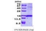 SSR4, 24-144aa, Human