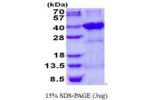 SDCBP2, 1-292aa, Human