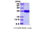 MRRF, 56-262aa, Human