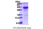 CDK5, 1-292aa, Human