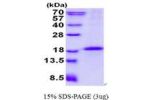 CD79B, 29-159aa, Human