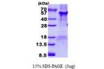 PARD6B, 1-372aa, Human