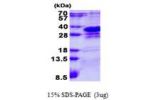 CHMP1A, 1-196aa, Human