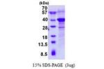 RWDD1, 1-243aa, Human