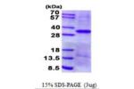EPCAM, 24-265aa, Human