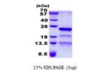 RP9, 1-155aa, Human