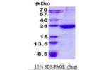 HEBP1, 1-189aa, Human