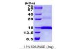 CD3E, 23-126aa, Human