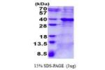 BCL7A, 1-210aa, Human