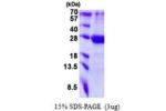 MED20, 1-212aa, Human