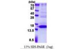 UFSP1, 1-142aa, Human
