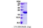 BCL2L10, 1-172aa, Human