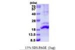RLN2, 25-185aa, Human