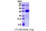 LSM12, 1-195aa, Human