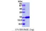 CDK2AP2, 1-126aa, Human