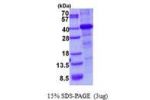 HFE, 23-306aa, Human
