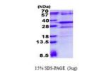 RSG1, 1-258aa, Human