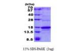 CD247, 52-164aa, Human