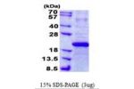 IFNA7, 24-189aa, Human