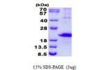 HAVCR2, 22-202aa, Human