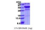 XRCC3, 1-346aa, Human