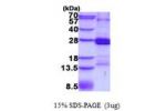 CD2, 25-209aa, Human