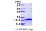 FDCSP, 18-85aa, Human