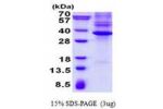 NKX3-1, 1-234aa, Human
