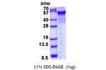 ARSG, 17-525aa, Human