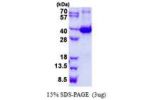 LGALS9, 1-322aa, Mouse