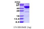 STK17B, 1-372aa, Human