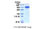 MYD88, 1-309aa, Human
