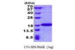 SDHAF2, 30-166aa, Human