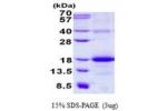 CLEC2B, 26-149aa, Human