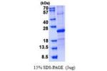 SOSTDC1, 24-206aa, Human