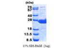 BPIFA1, 20-256aa, Human