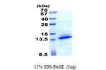 SAMD13, 1-102aa, Human