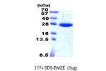 SAR1B, 1-198aa, Human