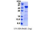 DNAJB4, 1-337aa, Human