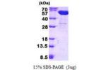 CNDP2, 1-475aa Human