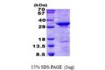 CD300C, 21-183aa Human